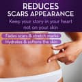 Cicatricure Advanced Scar Gel for Face Body Proven Results In 2 Weeks Scar - Thumbnail 2