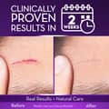 Cicatricure Advanced Scar Gel for Face Body Proven Results In 2 Weeks Scar - Thumbnail 3
