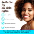 It's Pure Natural African Black Soap Bars With Acne Solution Organic Raw Soap - Thumbnail 3