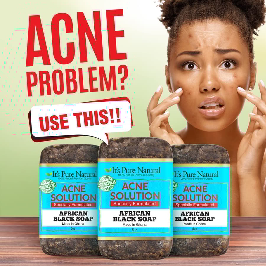 It's Pure Natural African Black Soap Bars With Acne Solution Organic Raw Soap
