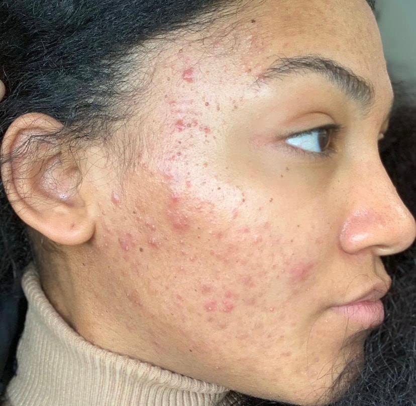 103 Collection Vegan Facial Toner With Provitamin A B5 B3 Sensitive Skin - Thumbnail 2