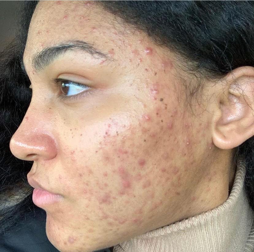 103 Collection Vegan Facial Toner With Provitamin A B5 B3 Sensitive Skin - Thumbnail 3