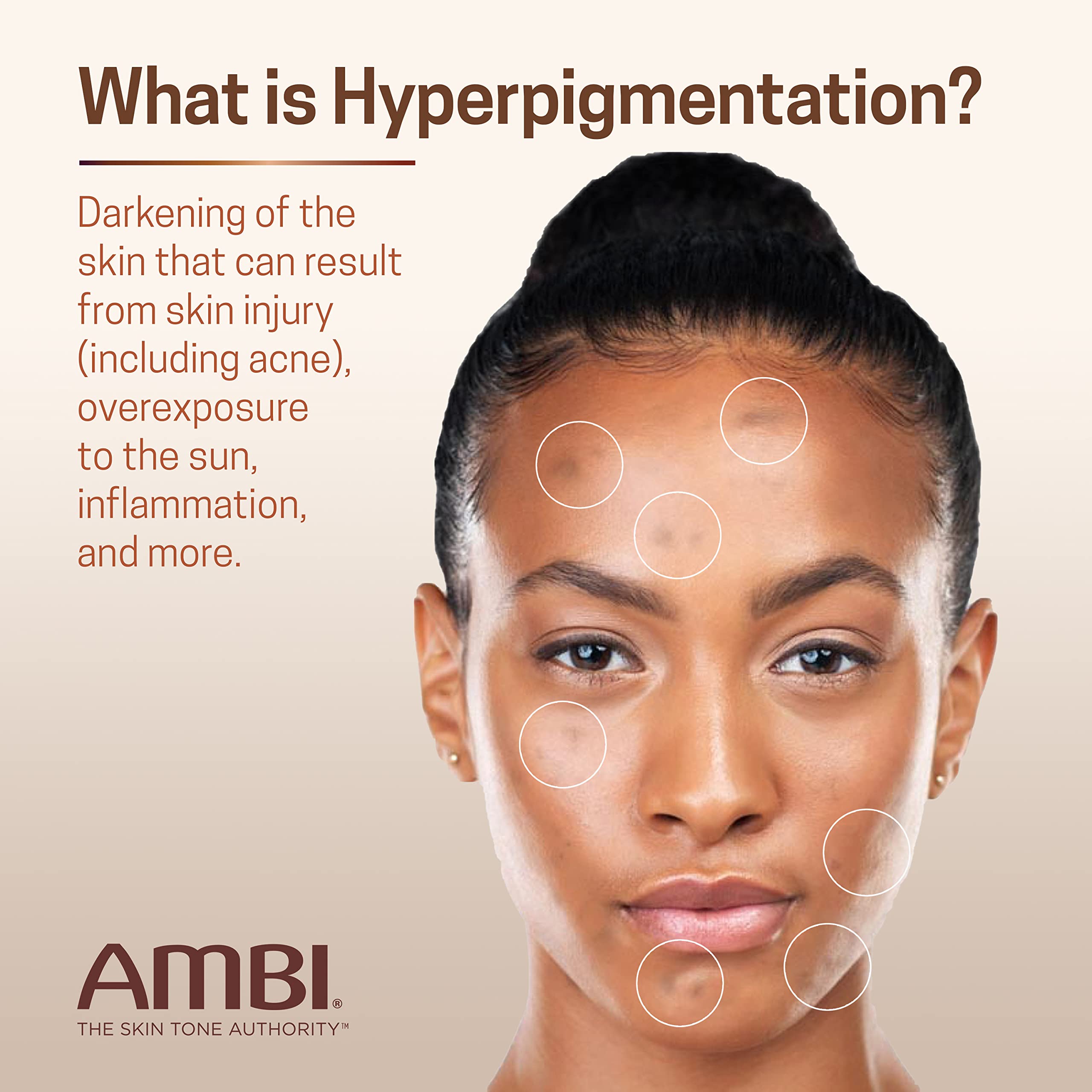 Ambi Even Clear Fade Cream Hydroquinone Free Hyperpigmentation Treatment Dark - Thumbnail 3