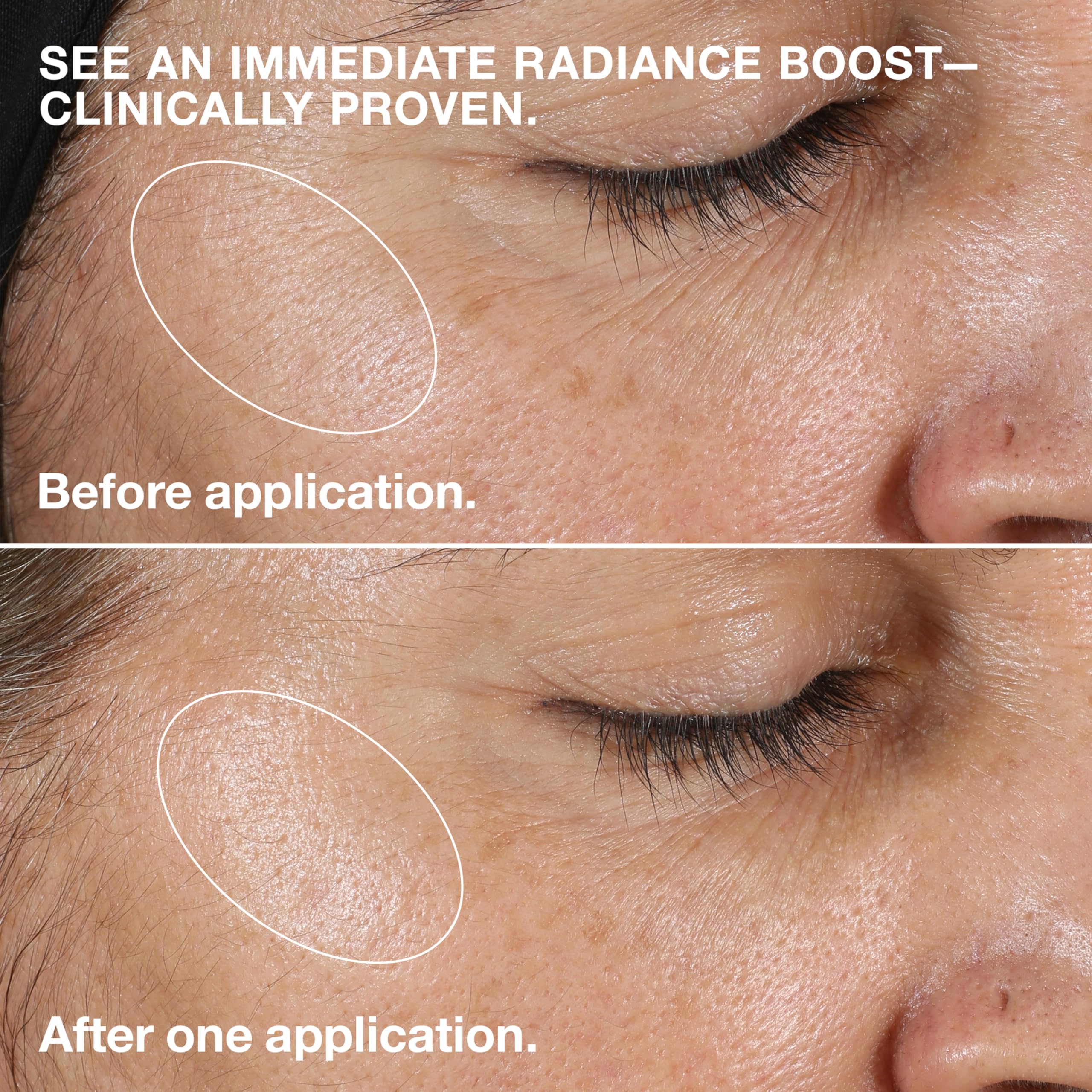 Clinique 3 Step Clarifying Lotion Face Exfoliator 2 | Toner With Witch Hazel | - Thumbnail 3