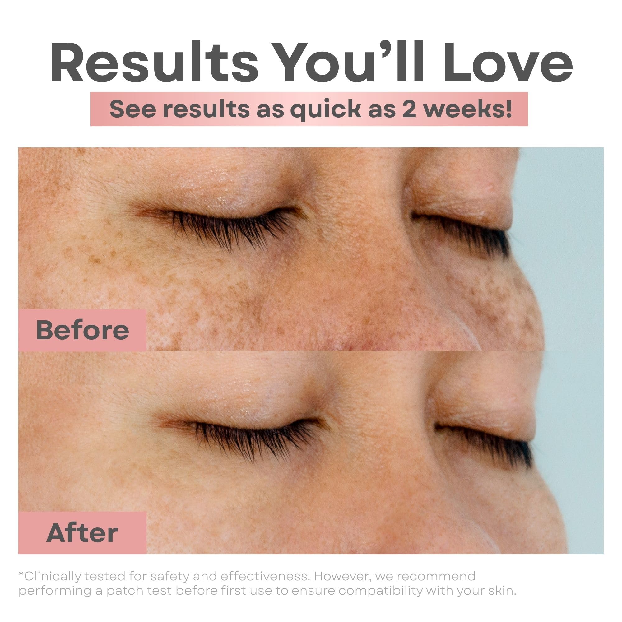 Clear Essence Brightening Dark Spot Serum Wand With Rollerball Vitamin C Serum - Thumbnail 3