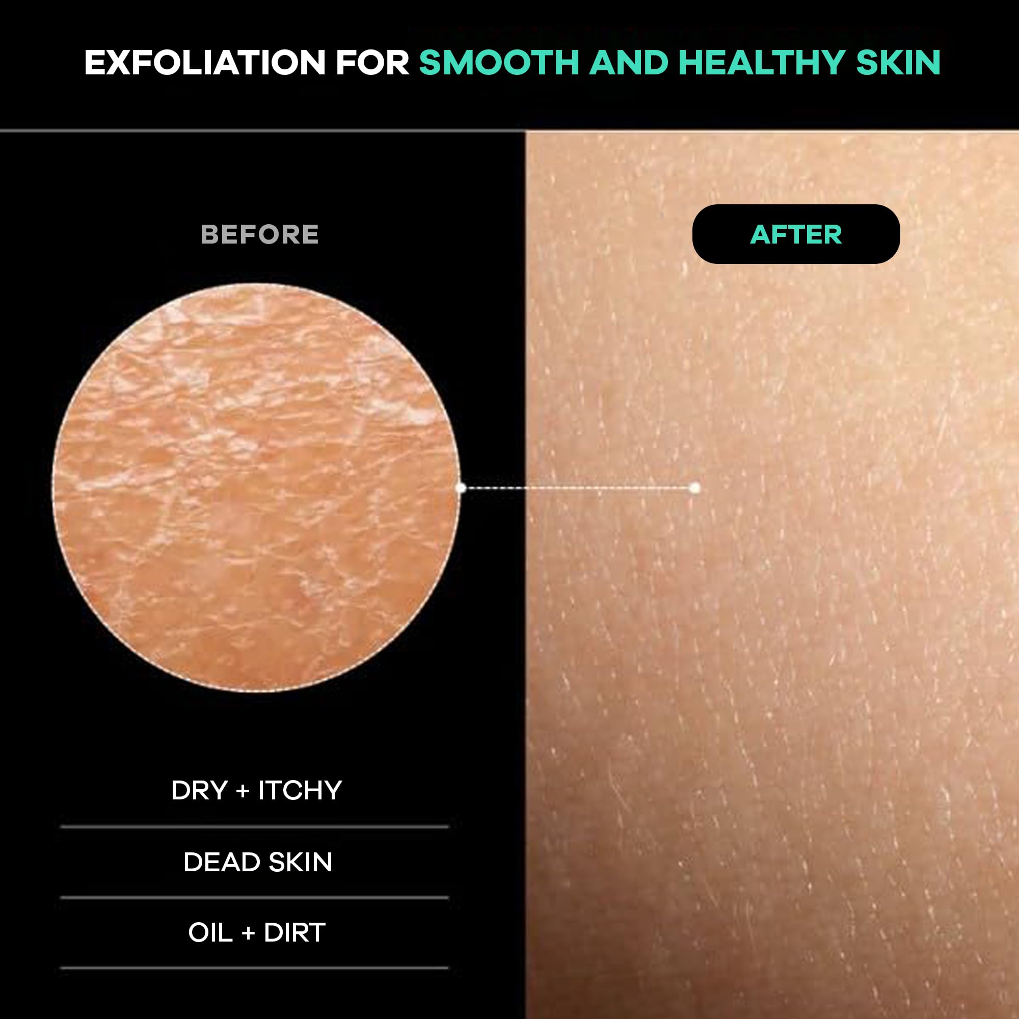 Dermasuri Deep Exfoliating Back Scrubber Bath Shower Back Scrub Body Exfoliator - Thumbnail 3