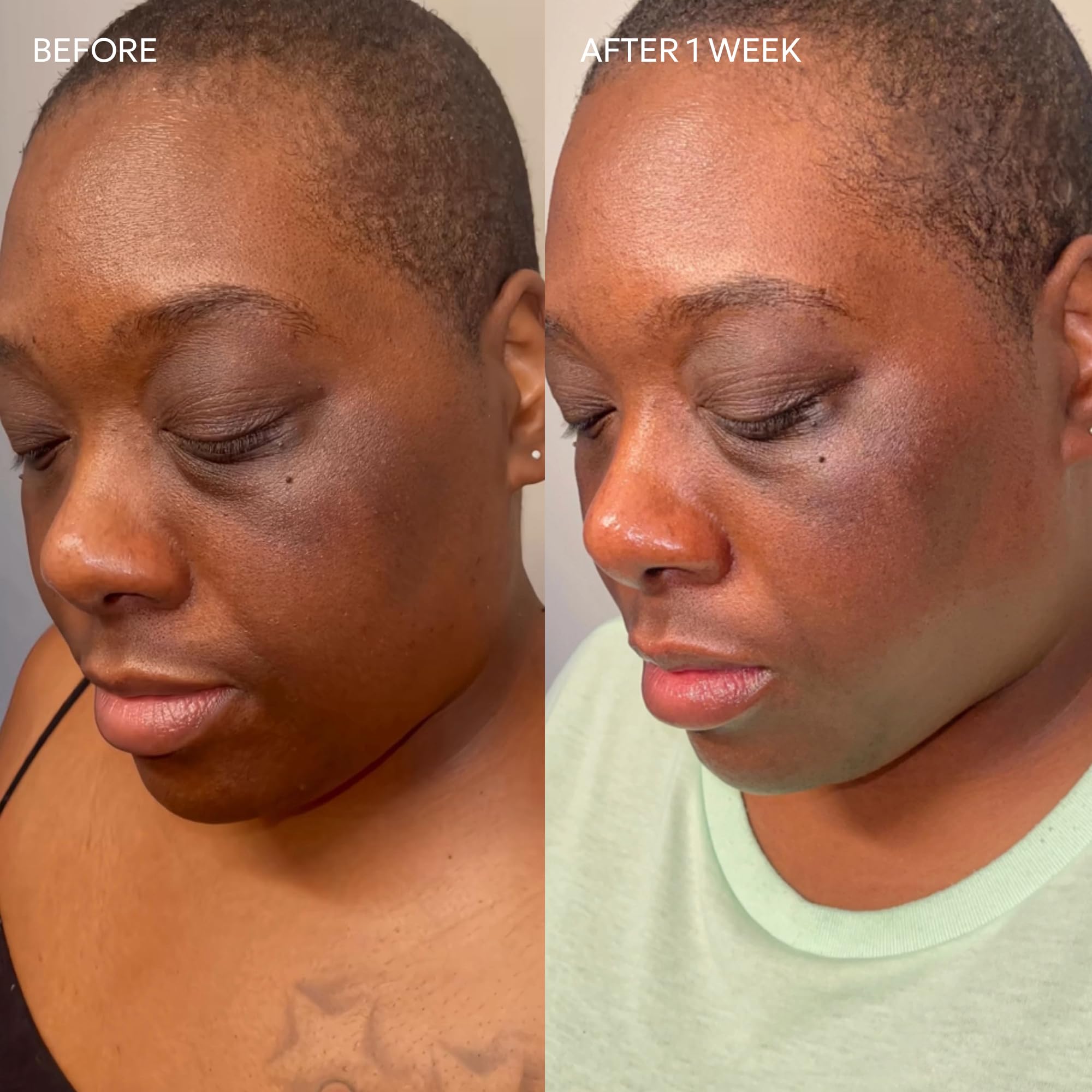 Dermisa Brightening Bar With Kojic Acid Licorice Root Bearberry Extract | No - Thumbnail 3