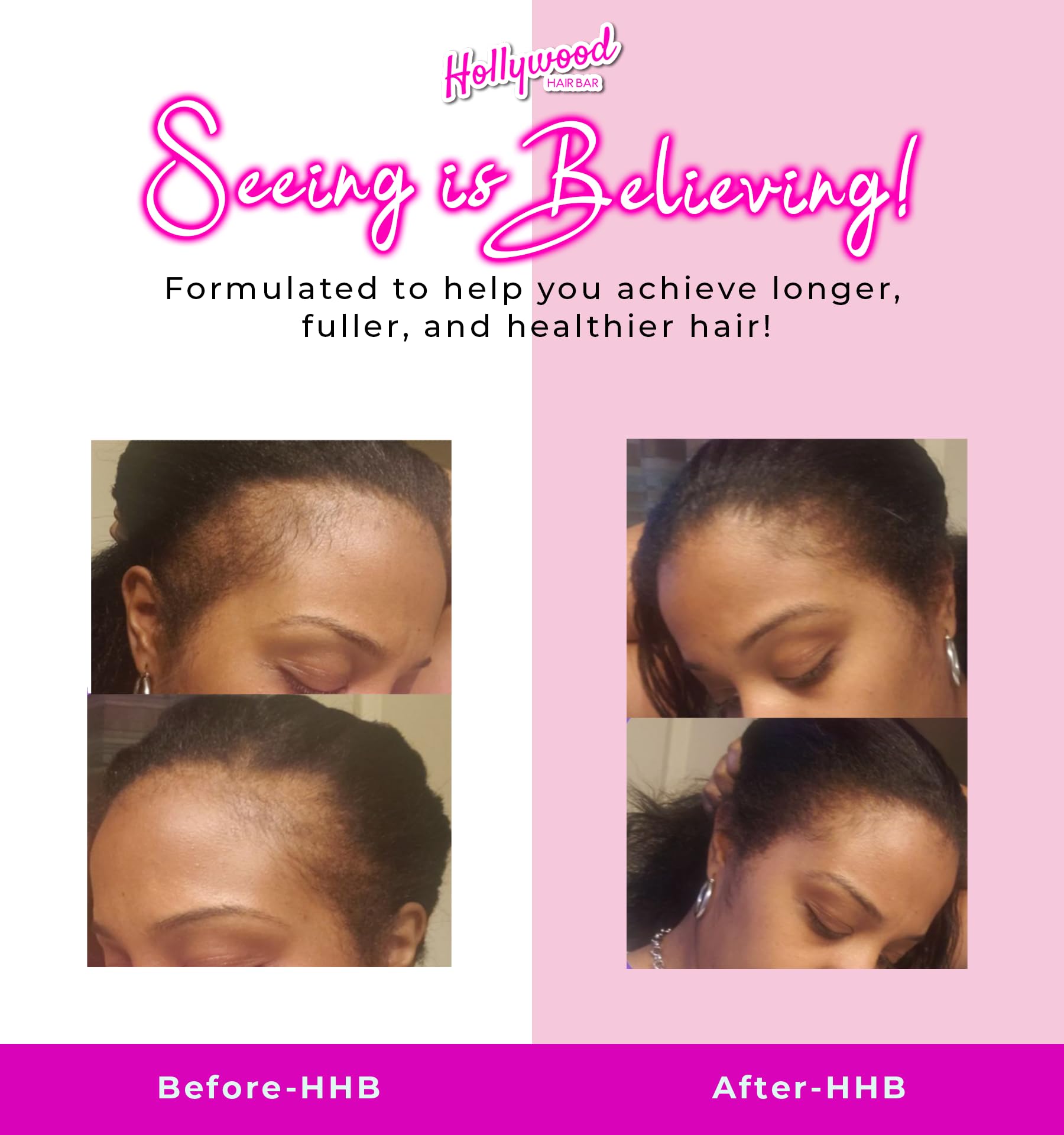 Hollywood Hair Bar Super Grow Scalp Balm Revitalizing Scalp Balm Vegan and - Thumbnail 2