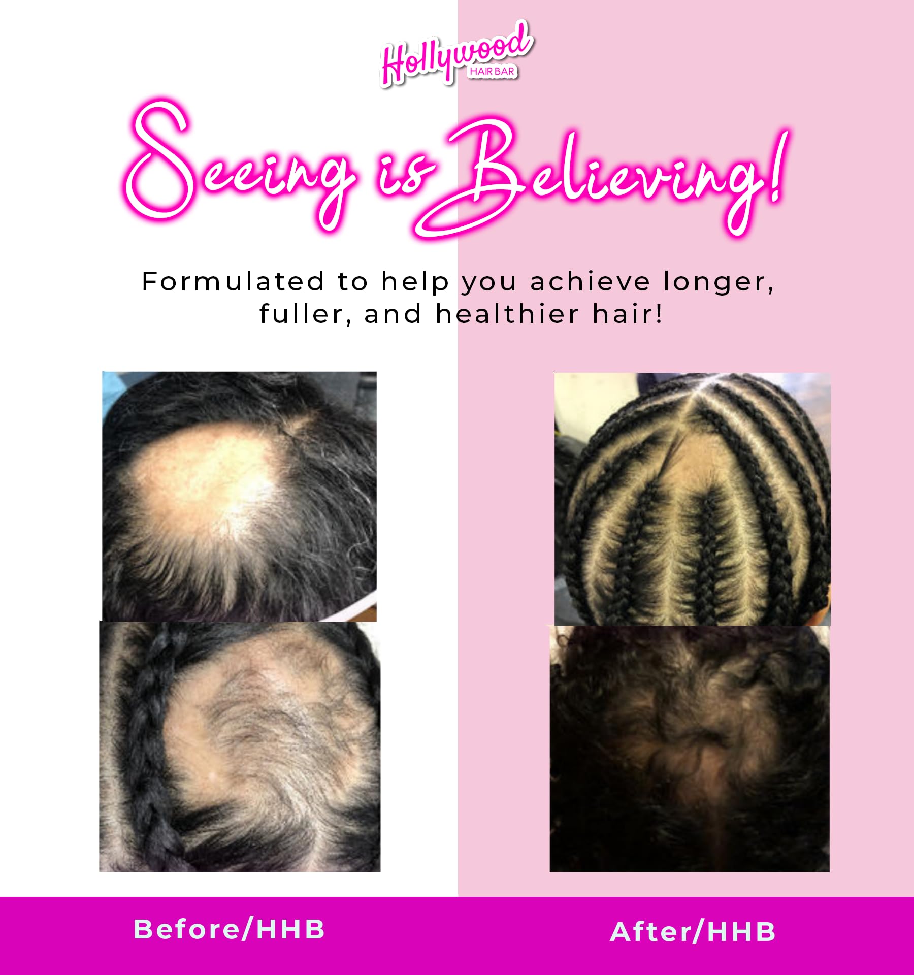 Hollywood Hair Bar | Hair Oil Regrowth Serum Extra Strength Vegan and Cruelty - Thumbnail 3