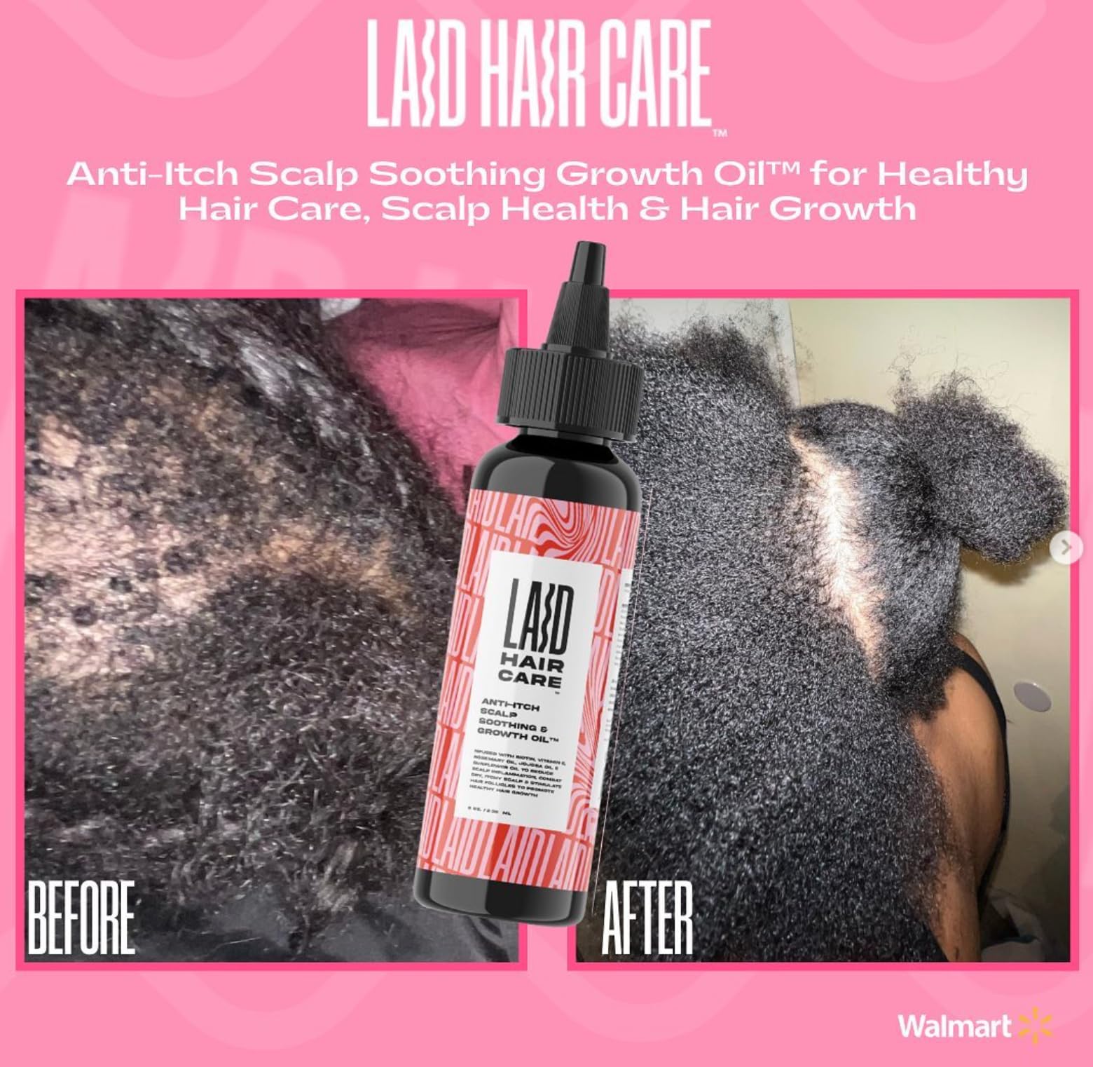 Laid Hair Care Anti Itch Scalp Soothing Mega Growth Oil - Thumbnail 3