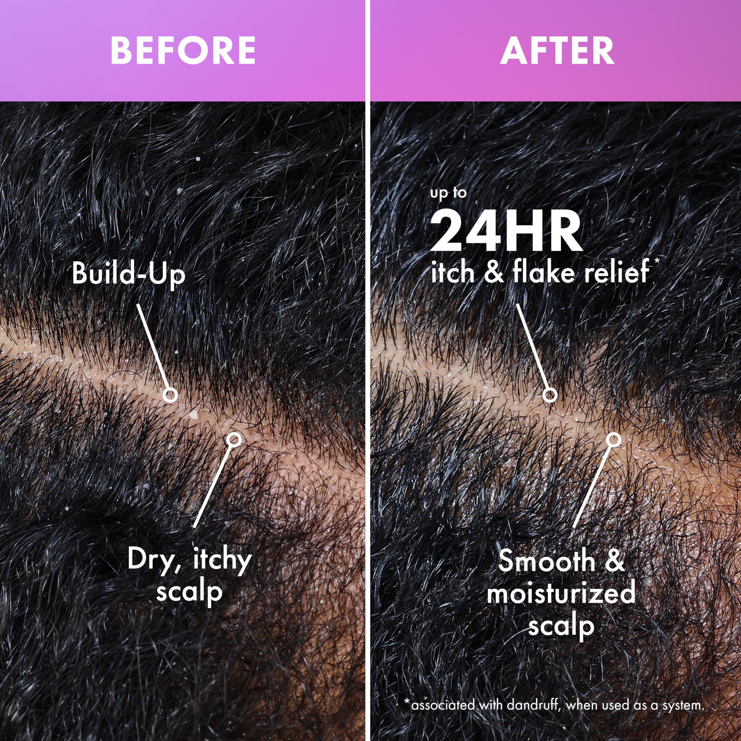 Mielle Organics Lavender Lychee Scalp Hair Build Up Remover Clarifying Pre - Thumbnail 2
