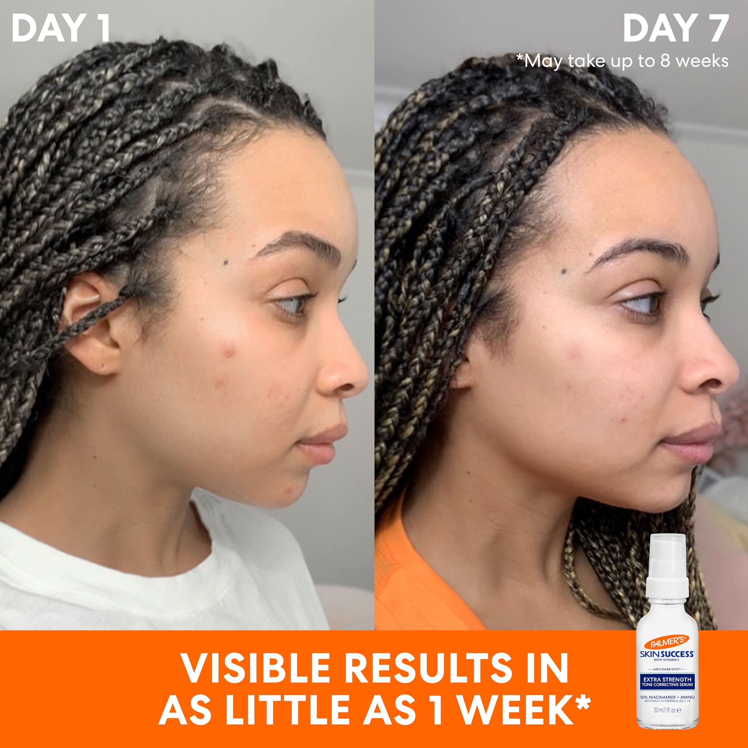 Palmer's Skin Success Extra Strength Tone Correcting Face Serum 1.0 Fl Oz Dark - Thumbnail 3