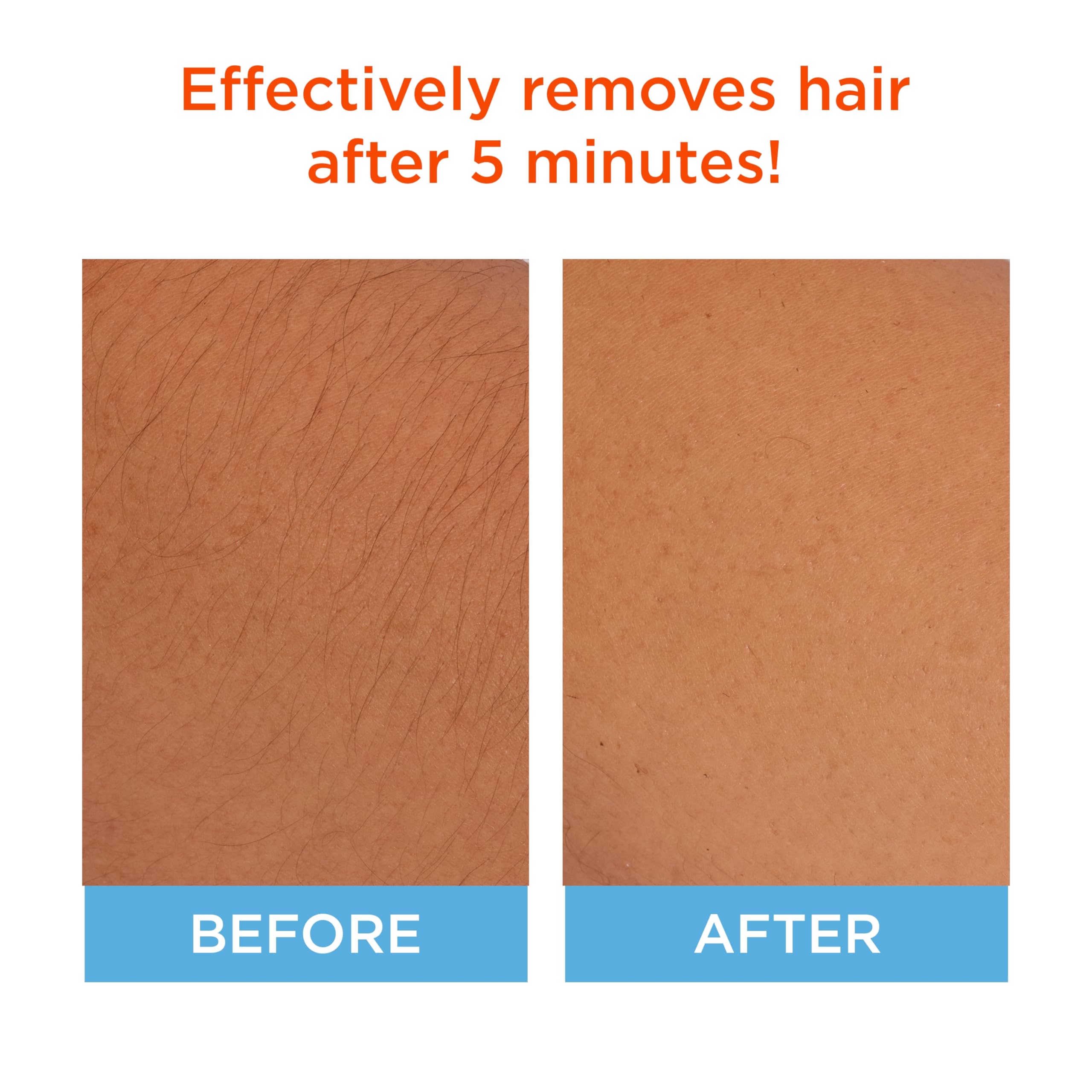 Sally Hansen Hair Remover for Face | Cream Depilatory + Aftercare Lotion | - Thumbnail 2