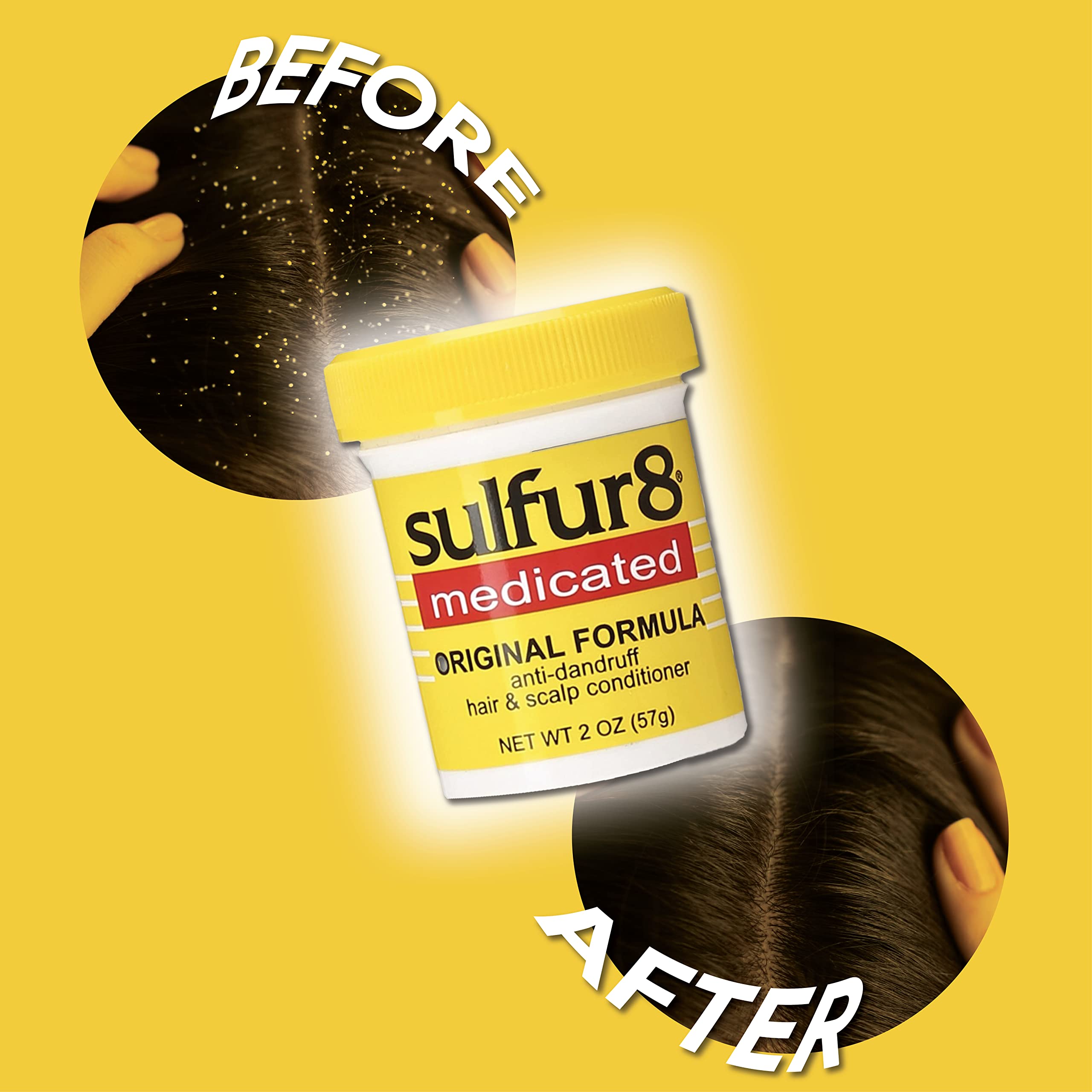Sulfur 8 Medicated Anti Dandruff Hair Scalp Conditioner Helps Control Dandruff - Thumbnail 3