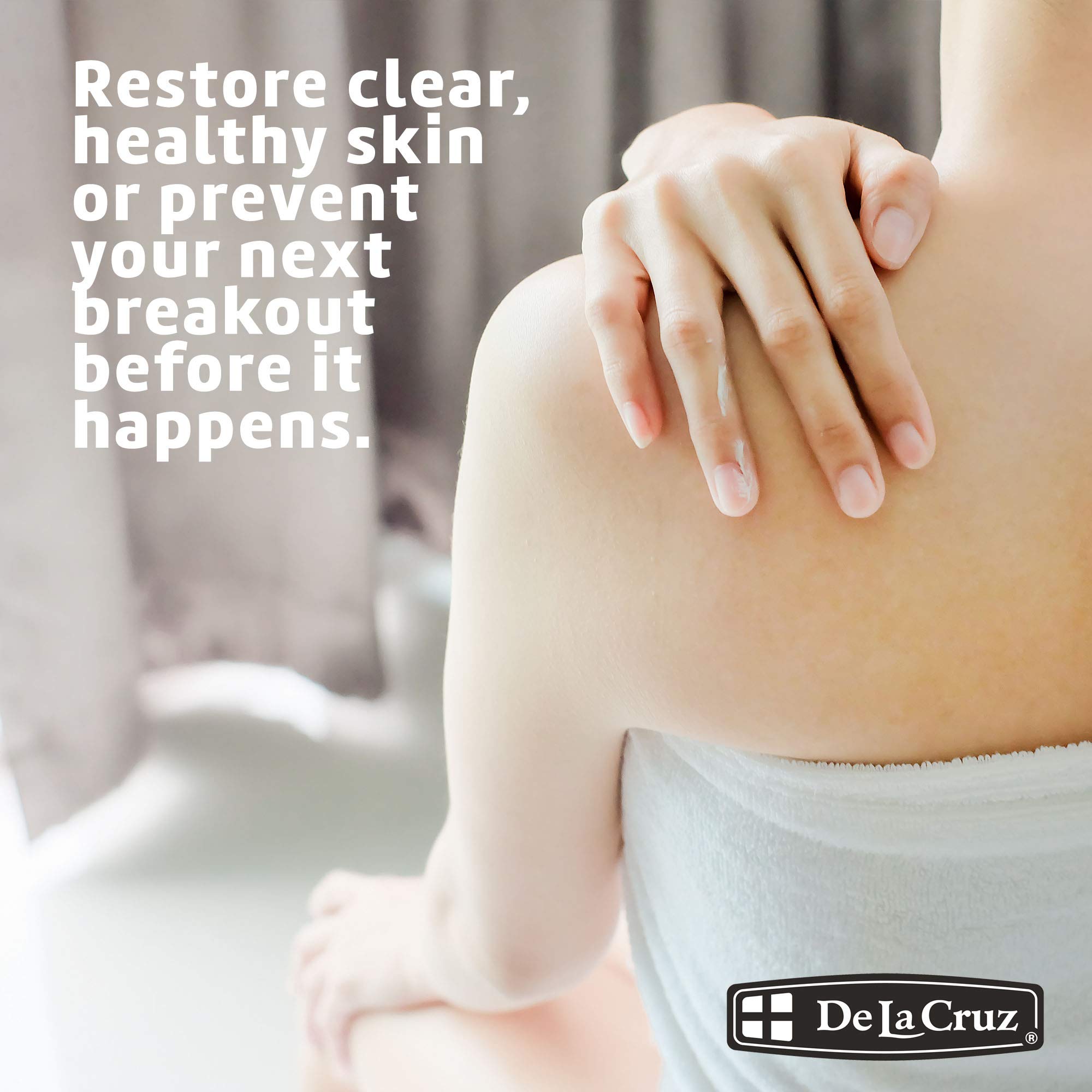 De la Cruz 10% Sulfur Ointment Cystic Acne Treatment for Face and Body Daily 10 - Thumbnail 3